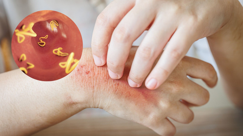 Sán chó Toxocara canis và các hình ảnh nhận diện ban đầu