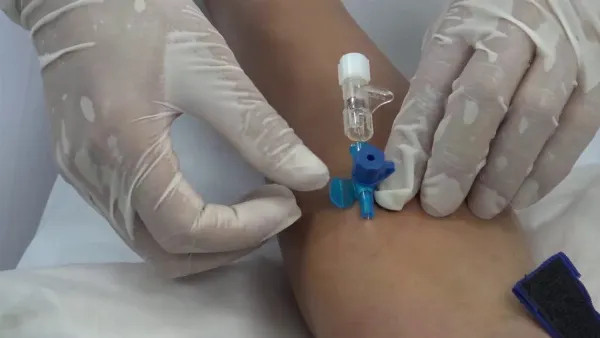 Bác sĩ cẩn thận đưa kim truyền vào tĩnh mạch