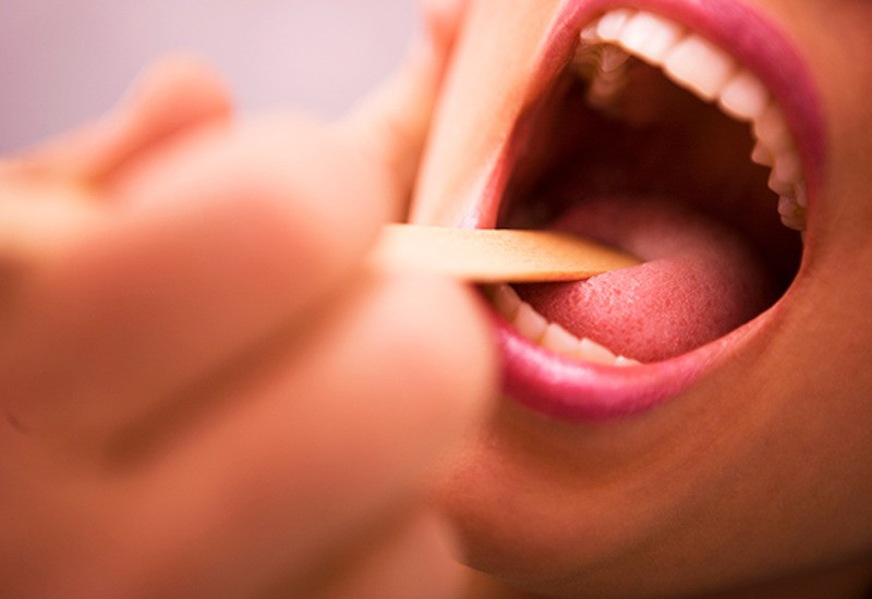 Phối hợp điều trị và chăm sóc tại nhà để đẩy lùi viêm gai lưỡi