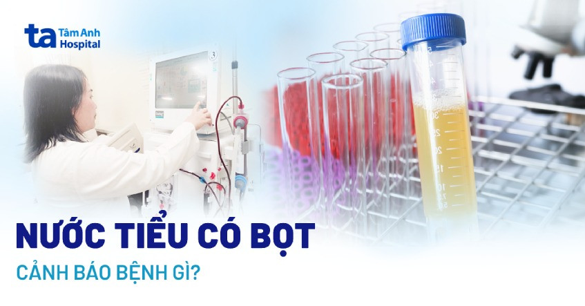 Nước tiểu có bọt