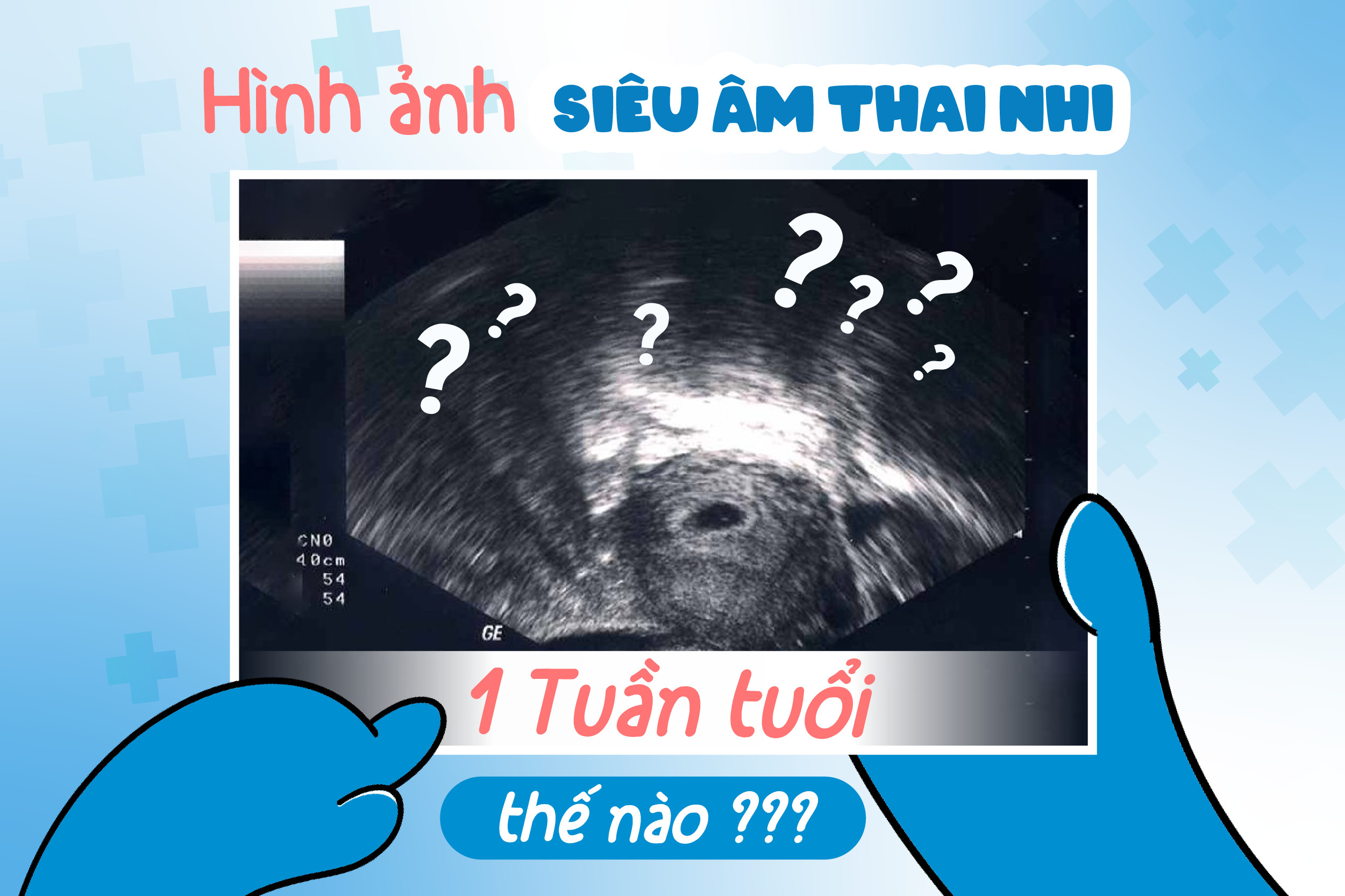 Hình ảnh minh họa một phụ nữ đang có biểu hiện nghi ngờ mang thai