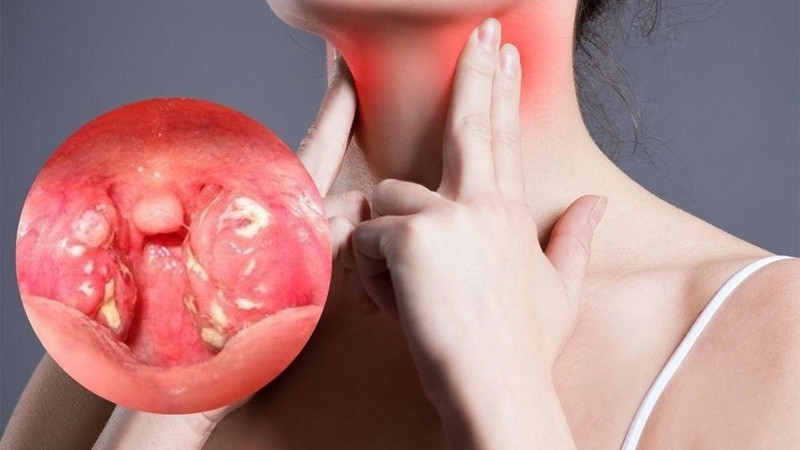Cơ thể hình thành giả mạc như một cơ chế tự nhiên để bảo vệ vết thương