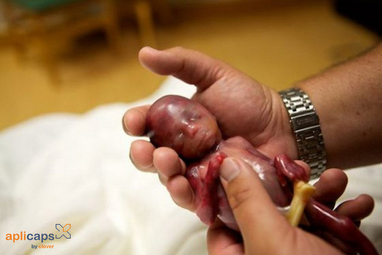 Thai nhi có kích thước bằng với bàn tay người lớn