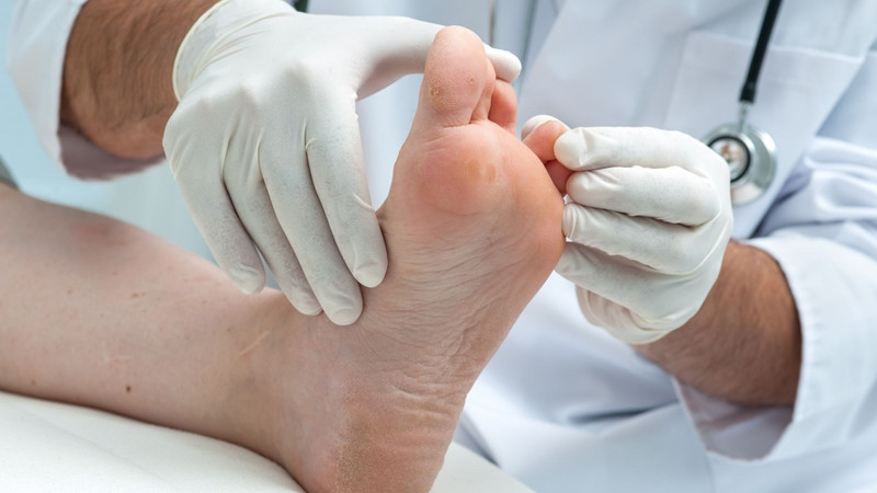 Ngay khi phát hiện các triệu chứng nghi ngờ, người bệnh nên đến cơ sở y tế uy tín hoặc bệnh viện chuyên khoa da liễu để thăm khám