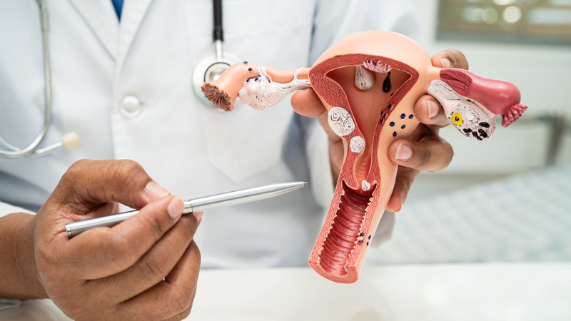 Cáº£i thiá»‡n tÃ¬nh tráº¡ng sa tá»­ cung Ä‘á»™ 1 nhá» luyá»‡n táº­p Kegel vÃ  thay Ä‘á»•i lá»‘i sá»‘ng