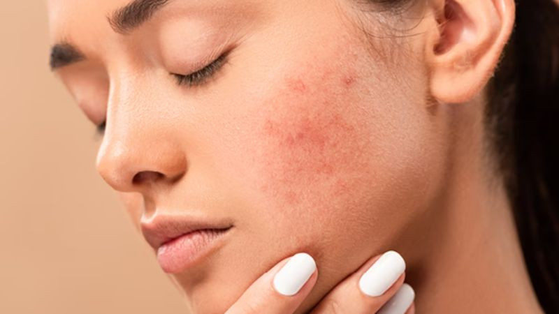 Hình ảnh minh họa tác động của tia hồng ngoại đến da