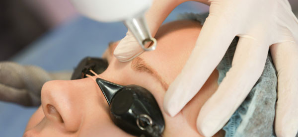 Quy trình xóa nám bằng laser