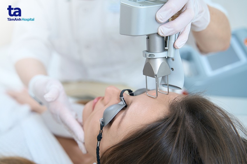 Người bệnh được đeo kính bảo hộ trong suốt quá trình thực hiện thủ thuật