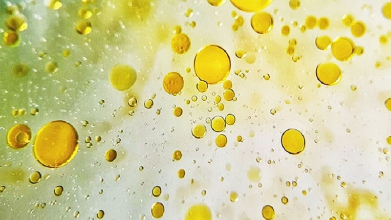 Nước tiểu có váng mỡ phản ánh sự hiện diện của lipid hoặc các hợp chất liên quan